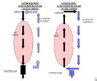 The left image displays the atrioventricular node 