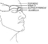 Forehead subunits. Illustrated by Charles Norman.