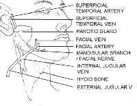 Course of the marginal mandibular nerve. Illustra...