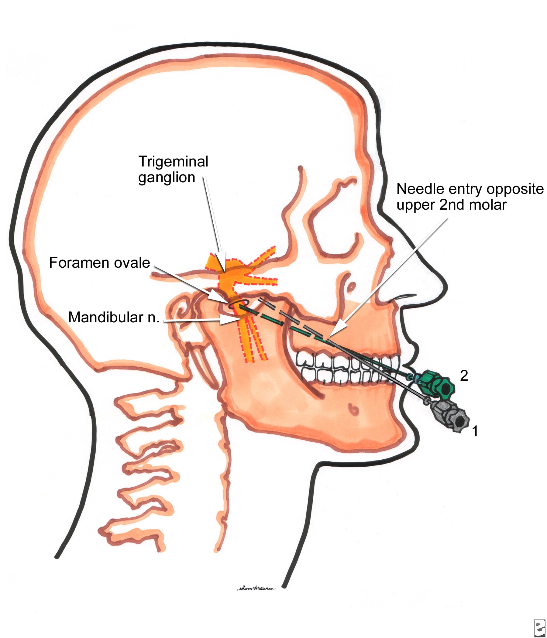 ganglion impar