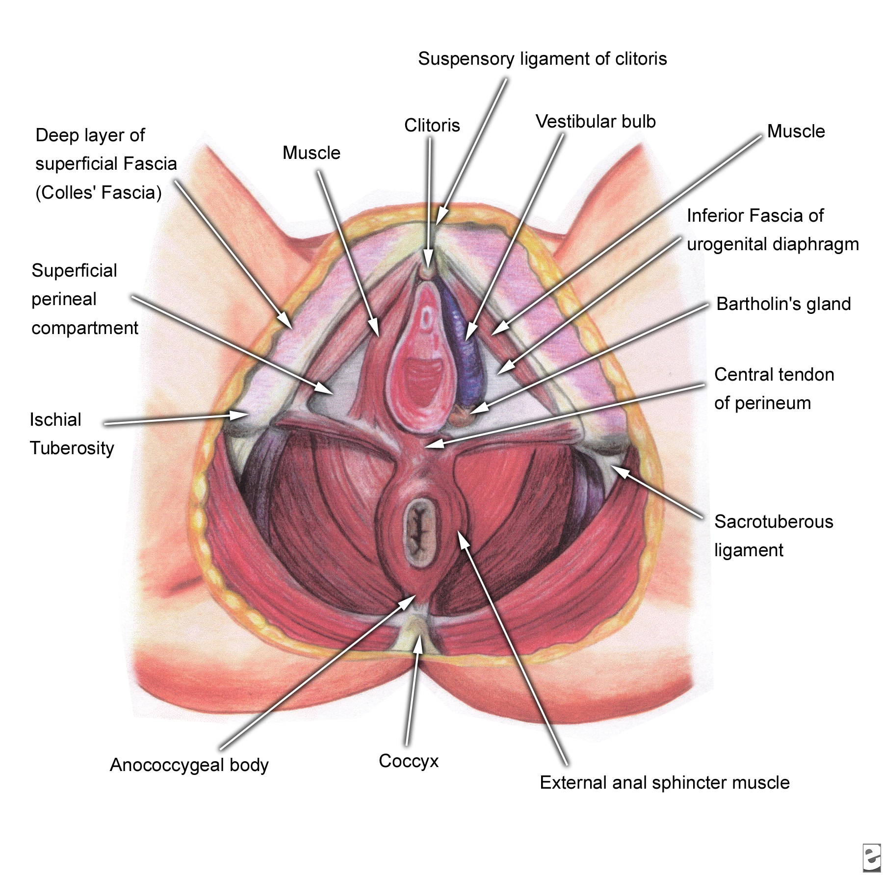 Recurrent fissuring of posterior fourchette | DermNet New ...