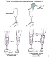 Lower Leg Prosthesis