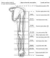 upper limb joints