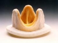 Carpentier-Edwards Duralex mitral bioprosthesis (p