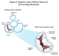 aortic mitral valve