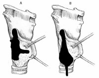 Parathyroid Gland Anatomy