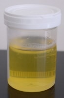 17 ketosteroids urine