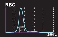 Determination of RDW-SD measurement. In this examp
