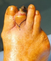 toe fish