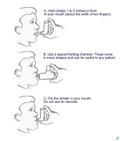 Asthma puffer steroids