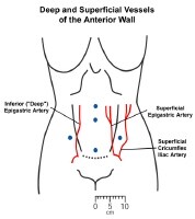 Abdominal Incision Types