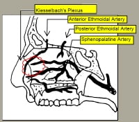 Anterior Epistaxis