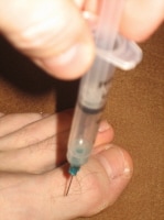 Plantar fascia steroid injection cpt code