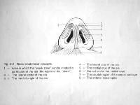 Nose anatomy, base. Image used with permission.