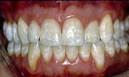 سایت دندانپزشکی دکتر رحمت سخنی Dr.Rahmat Sokhani