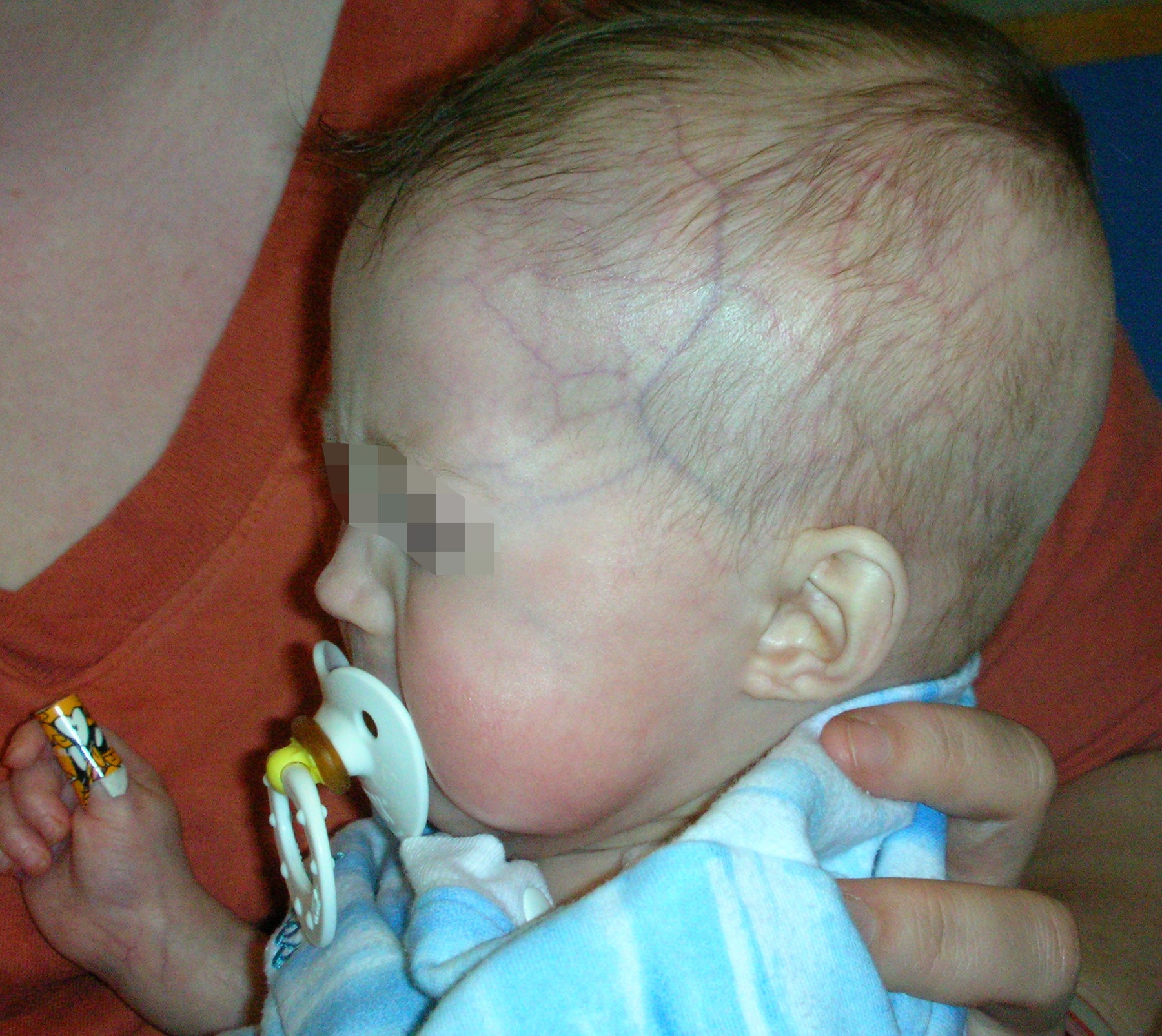 Medical Mystery Monday #108: the case of the balding baby ...
