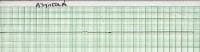 Rhythm strip showing asystole. 