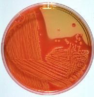 Shigella Macconkey