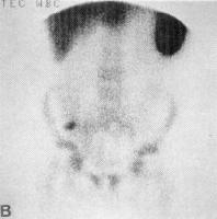 Technetium-99m radionuclide scan of the abdomen sh