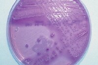 urine culture coli escherichia cfu workup greater colony than prostatitis chronic bacterial acute pathogen forming units common most medscape