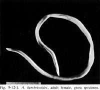 Ascaris Nematode