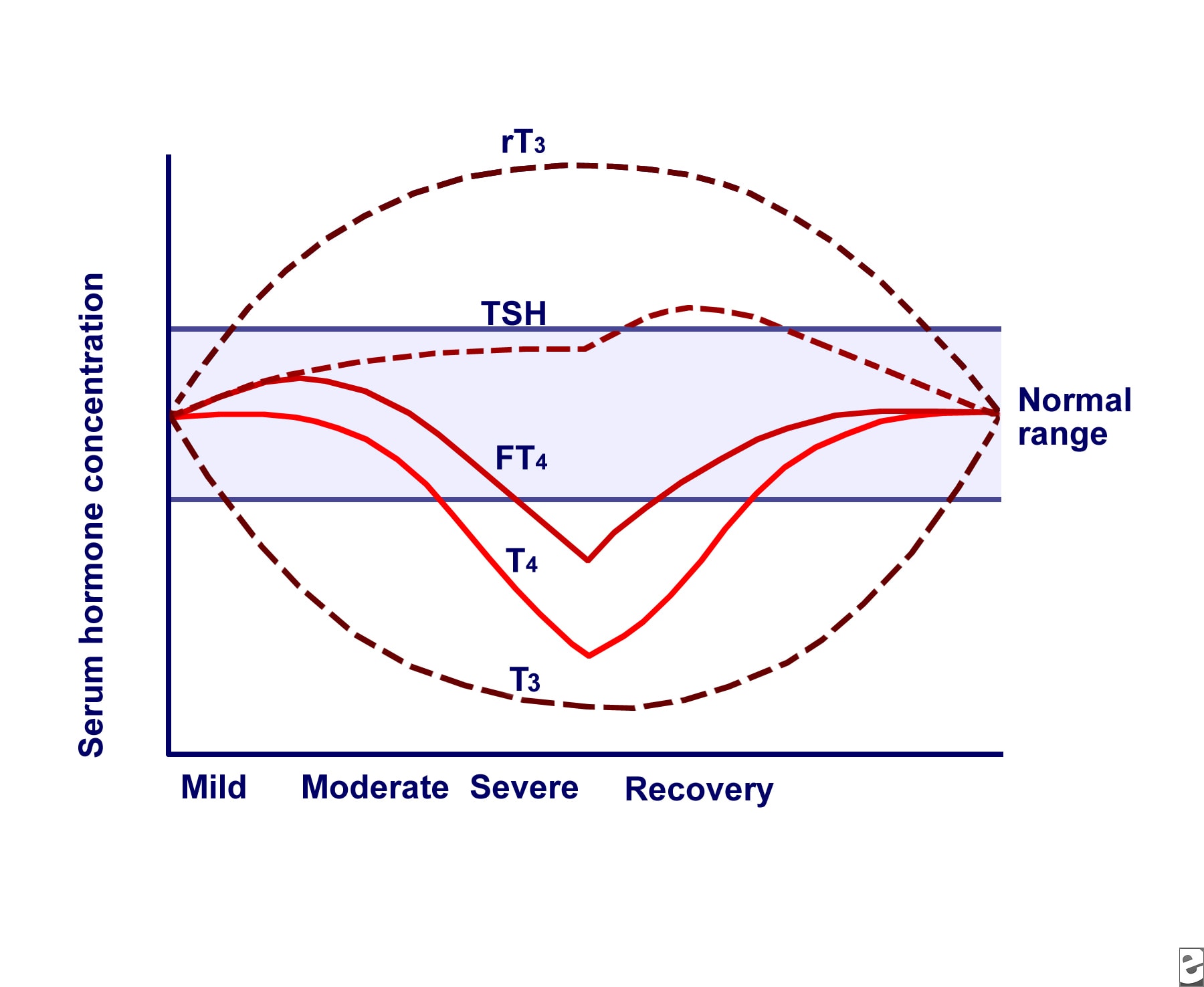 euthyroid sick syndrome