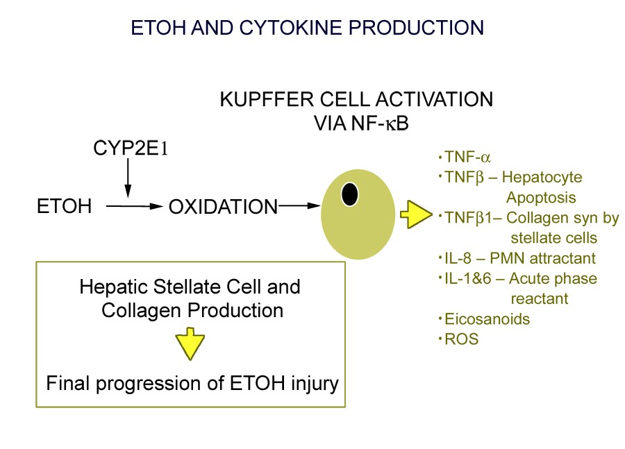 Alcoholic Hepatitis: eMedicine Gastroenterology emedicine.medscape.com