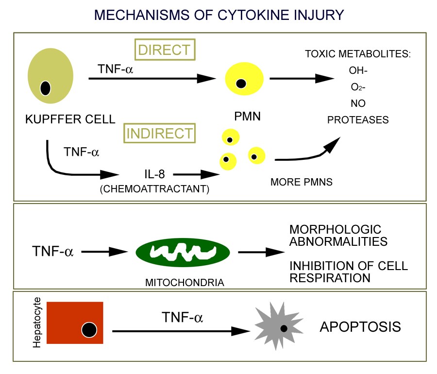 Alcoholic Hepatitis: eMedicine