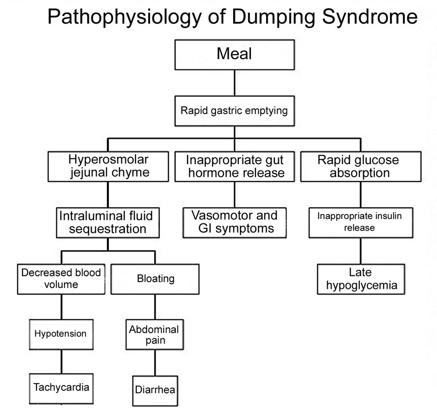Dumping Syndrome