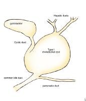 Cyst Types