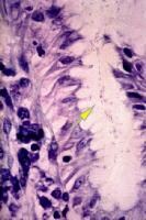 Home » Guidelines For The Management Of Helicobacter Infection In