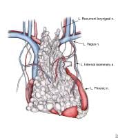 Thymoma Thymoma
