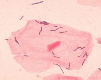 Lactobacilli and a squamous epithelial cell are ev