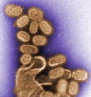 Negative stained transmission electron micrograph...