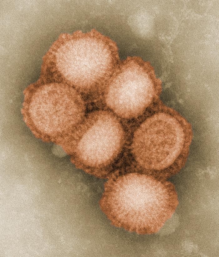  some of the ultrastructural morphology of the A/CA/4/09 swine flu virus.