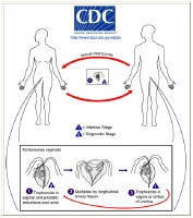 Trichomoniasis Diagram