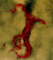 Bacillus Smear