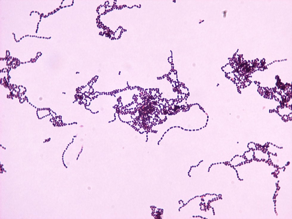 streptococcus pyogenes morphology
