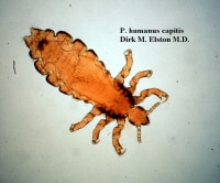 pubic lice facts