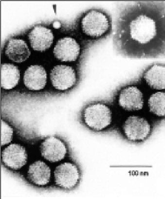 A virus image from the International Committee on...
