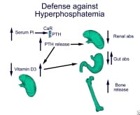  hyperphosphatemia