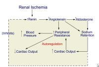 Proposed pathogenesis of renovascular hypertension