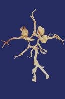 The circle of Willis has been dissected, and 3 ber