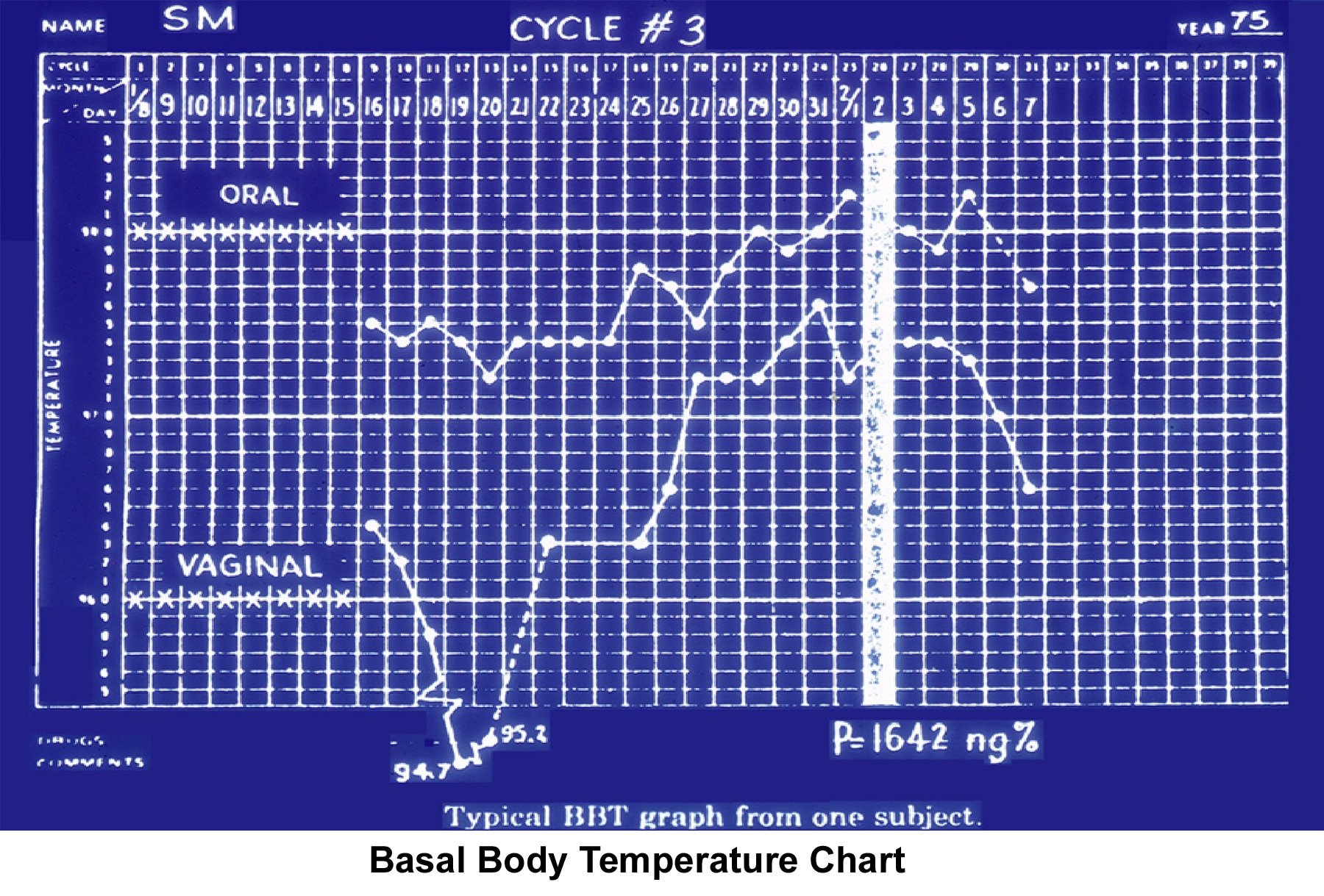 Infertility. Basal body temperature chart. Image...