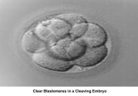 Infertility. Clear blastomeres in a cleaving embr...