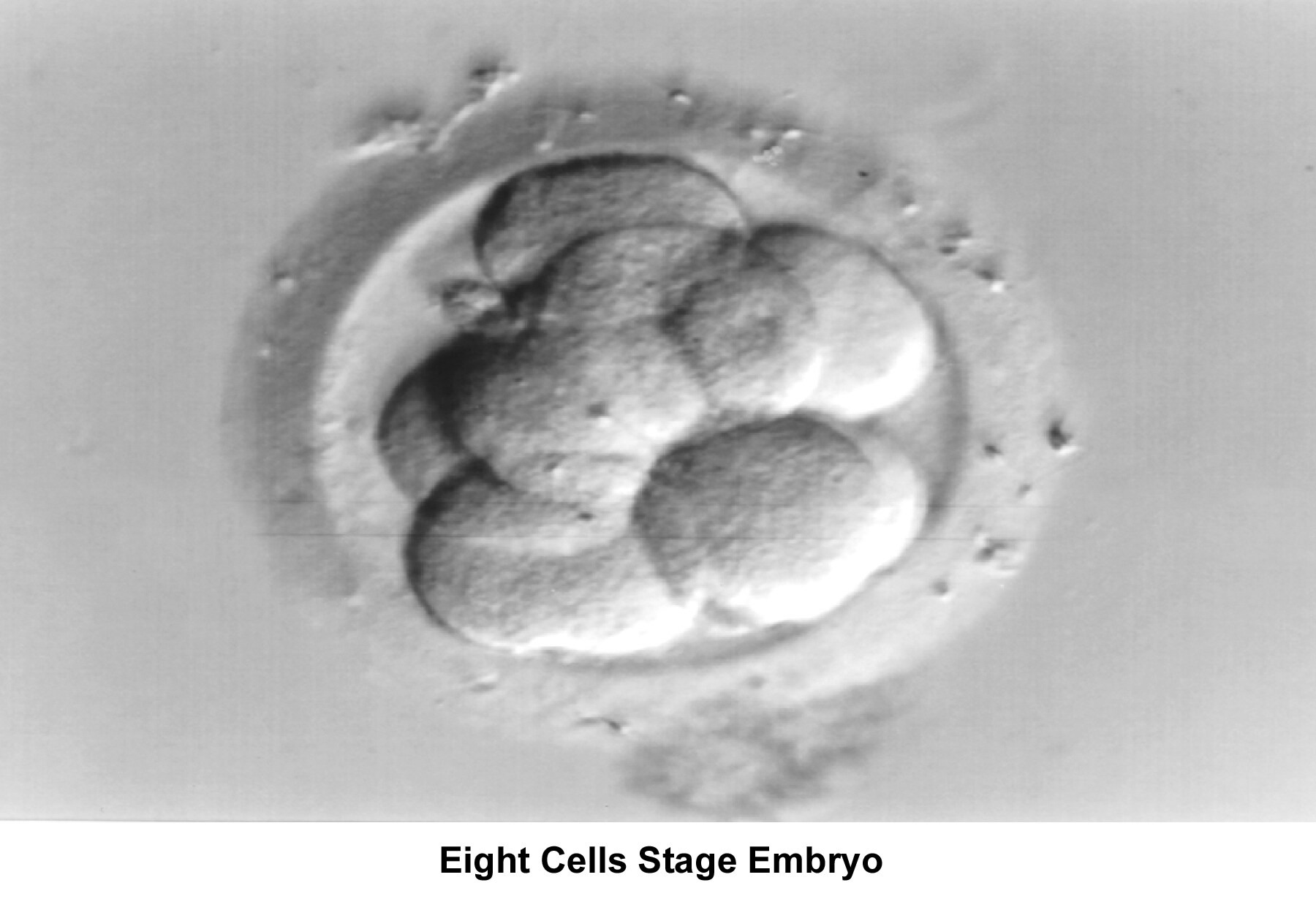 Infertility. Embryo (8-cell stage). Image courte...