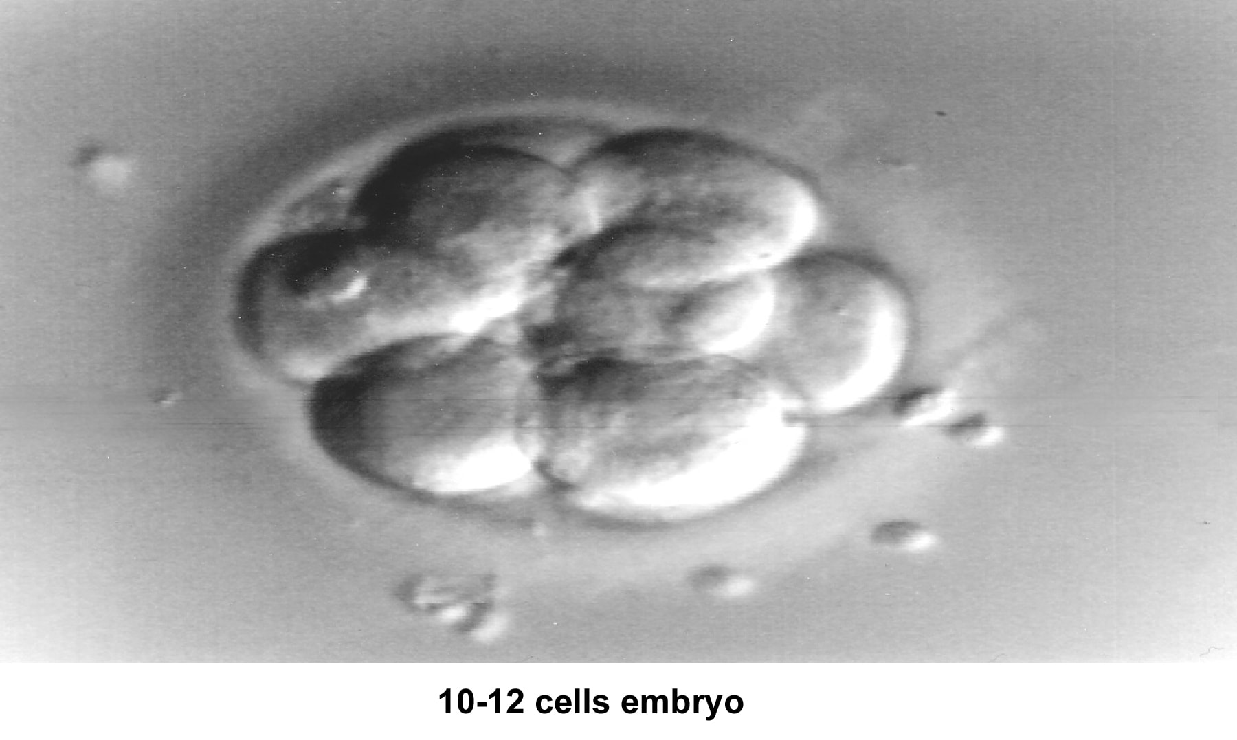 Infertility. Embryo (10- to 12-cell stage). Imag...