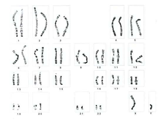 Karyotype showing normal male