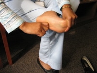 Plantar fascia tissue-specific stretching exercise