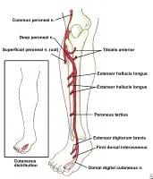 Deep Peroneal Neuritis